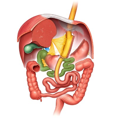 Illustration showing one anastomosis gastric bypass surgery