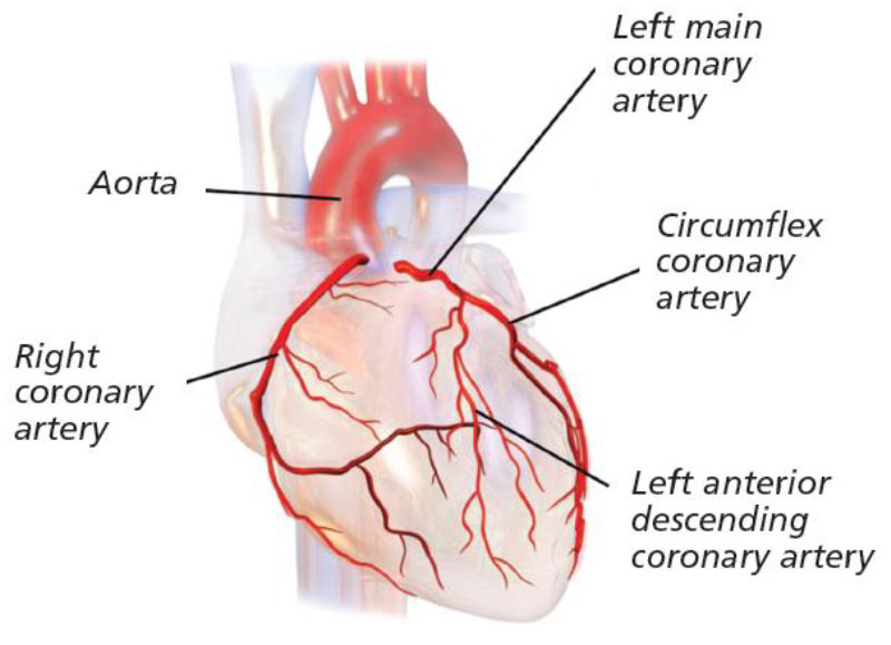 angiogram arteriogram szív egészsége)